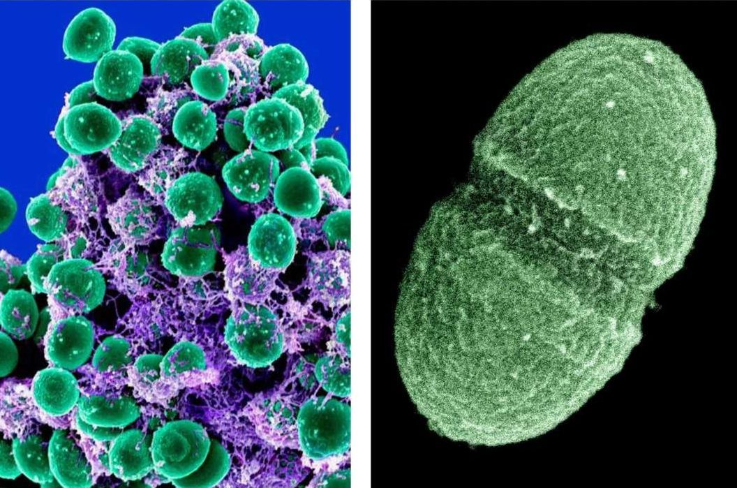 At left: Staphylococcus epidermidis bacteria (colored green) in the extracellular matrix, taken with a scanning electron microscope, showing. At right, image by the Agriculture Department showing the bacterium, Enterococcus faecalis,